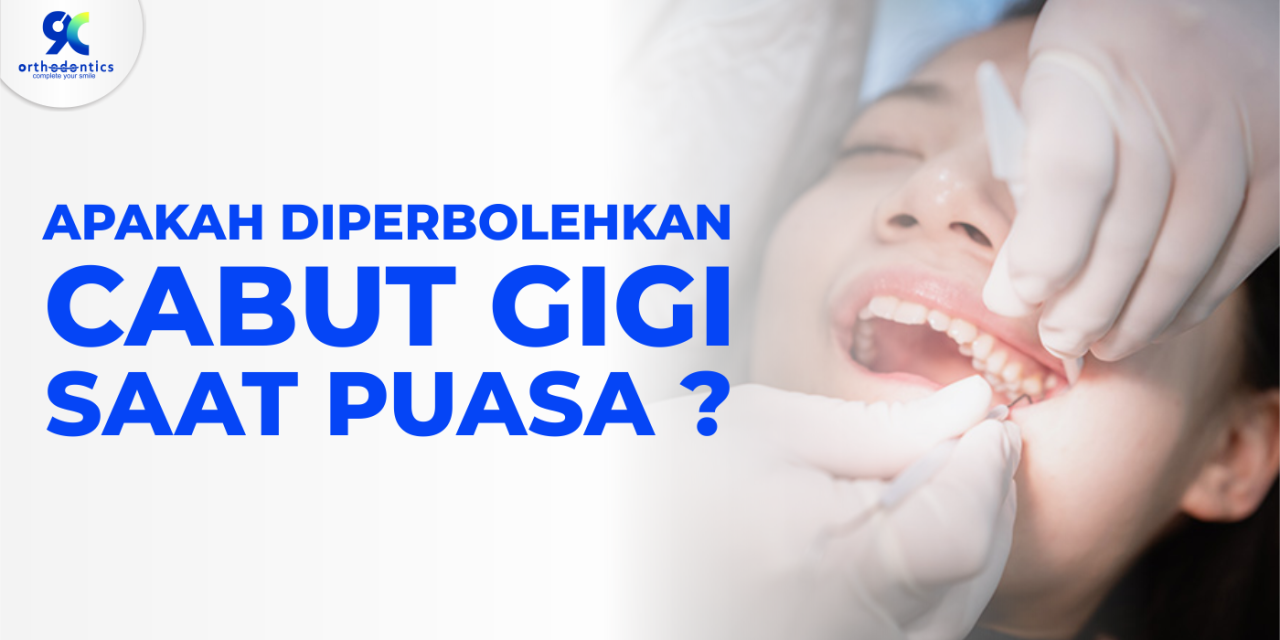 Panduan Cabut Gigi Saat Puasa, Ini Saran Dokter Gigi