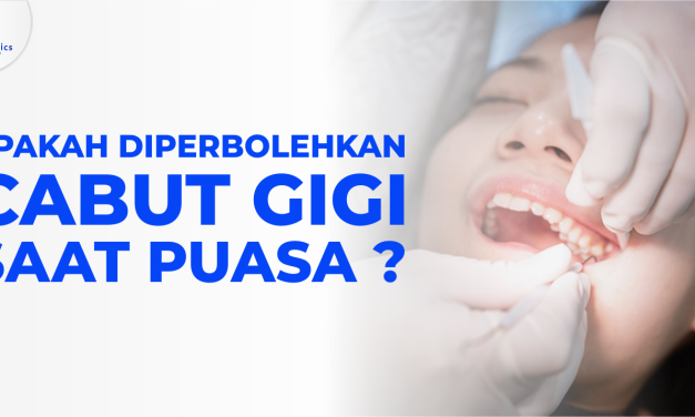 Panduan Cabut Gigi Saat Puasa, Ini Saran Dokter Gigi