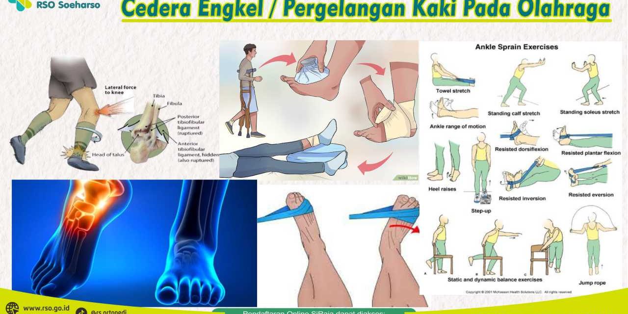 Sering Dialami Atlet, Ini 3 Cedera Paling Umum Di Indonesia
