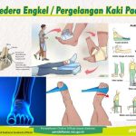 Sering Dialami Atlet, Ini 3 Cedera Paling Umum Di Indonesia